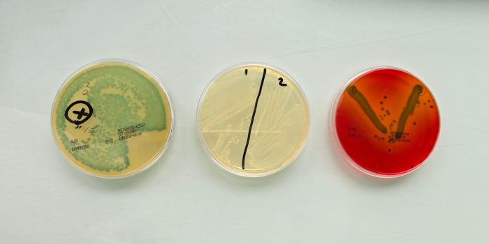 Listeria monocytogenes : un risque discret à surveiller particulièrement en été